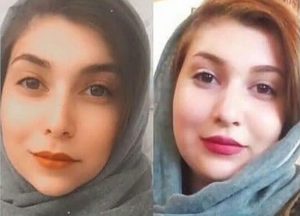 چاقی صورت با روش طبیعی